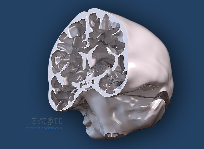 Solid 3D Human Brain