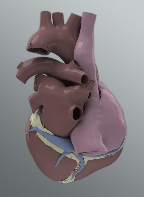 Solid 3D Human Heart