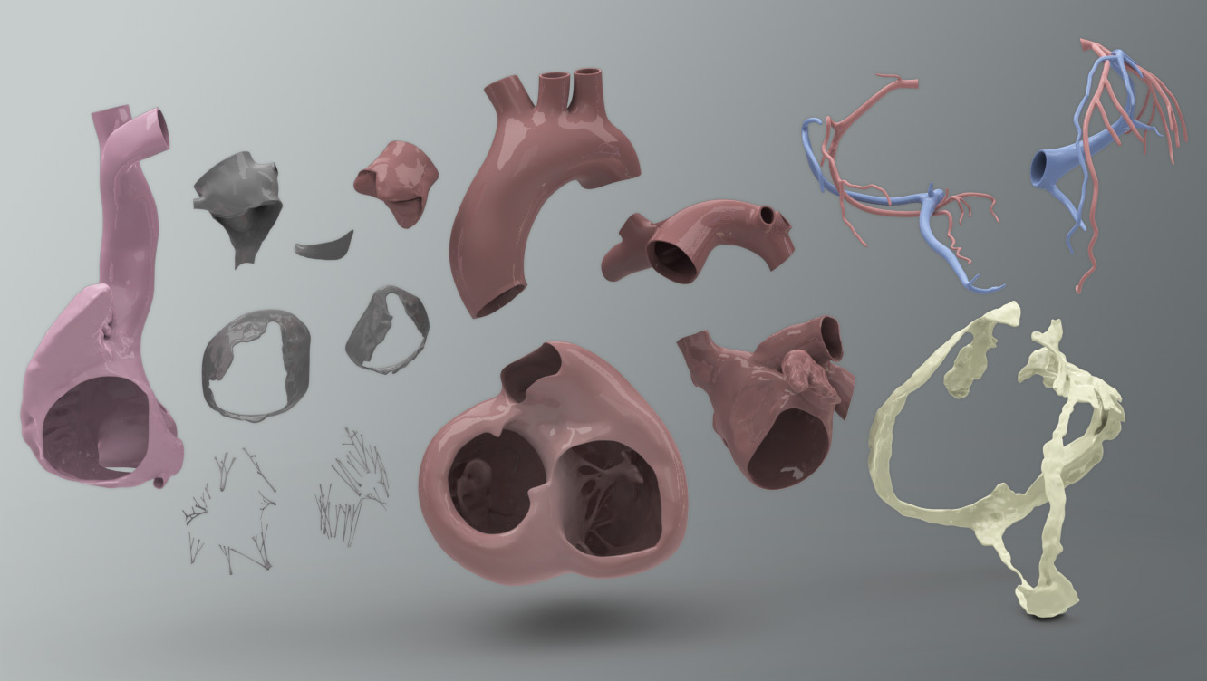 Solid 3D Human Heart