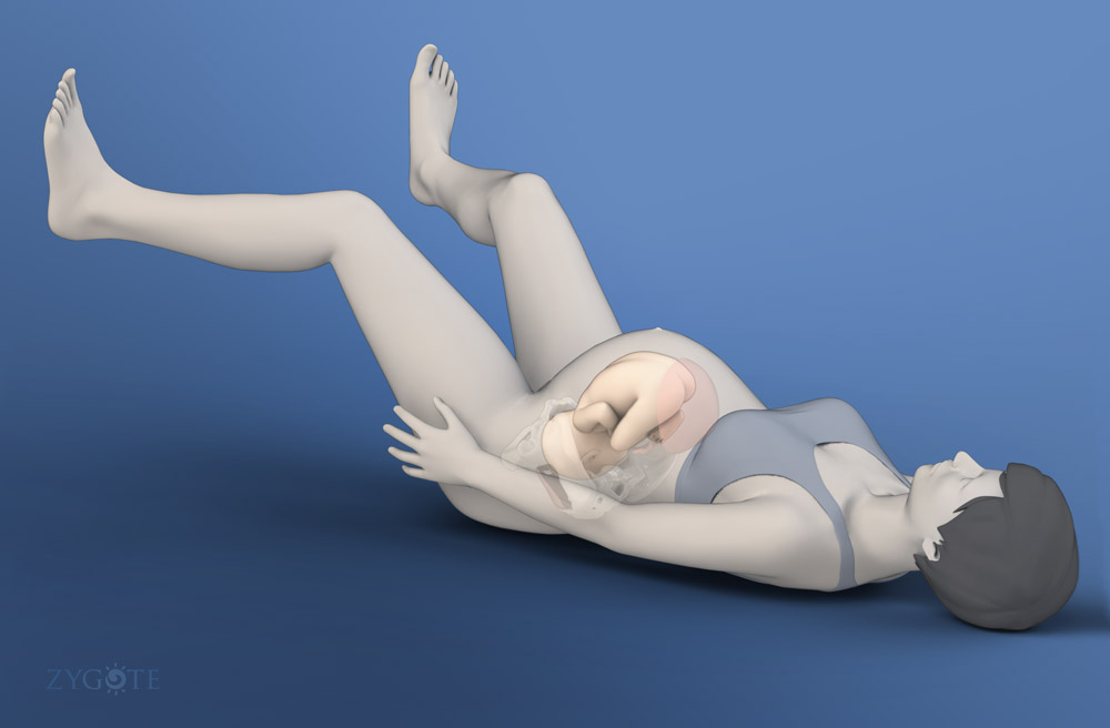 Solid 3D Pregnant Female