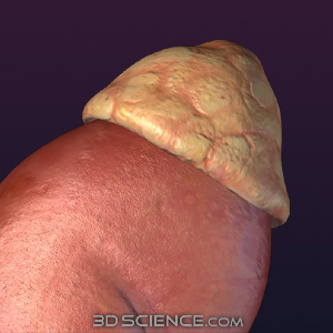 3D Female Adrenal Gland