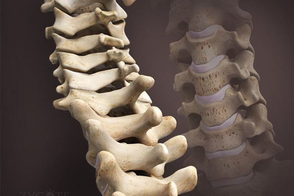 3D Spine Model