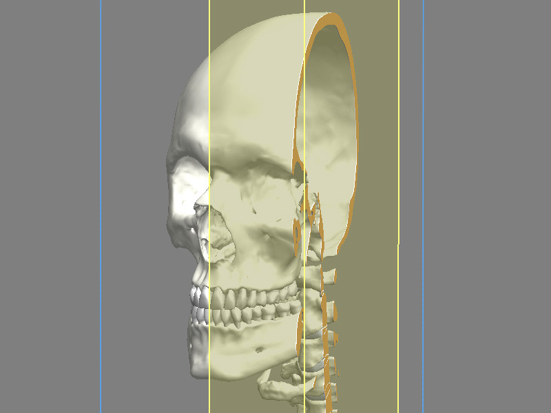 CAD Solid Skull Model